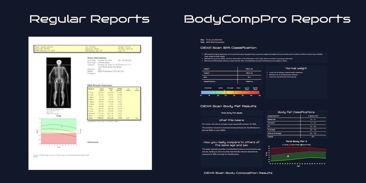 BodyComp Pro: The Future of Precision Body Composition Insight in the UK