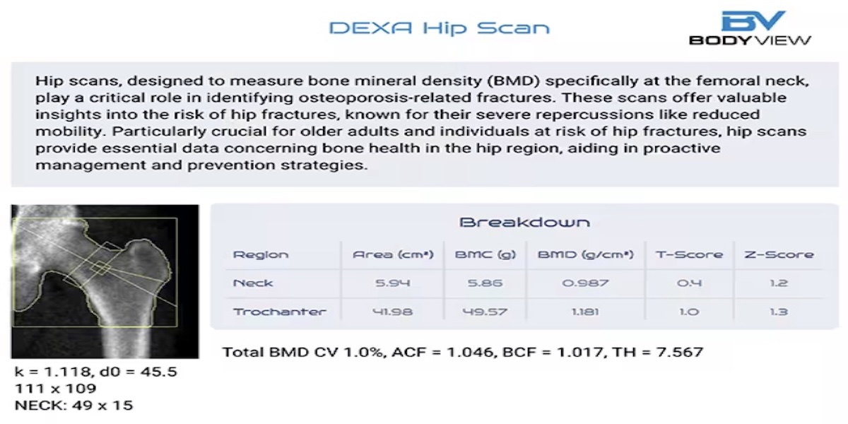 DEXA Bone Health Scans Now Available in Marylebone from 3rd June!