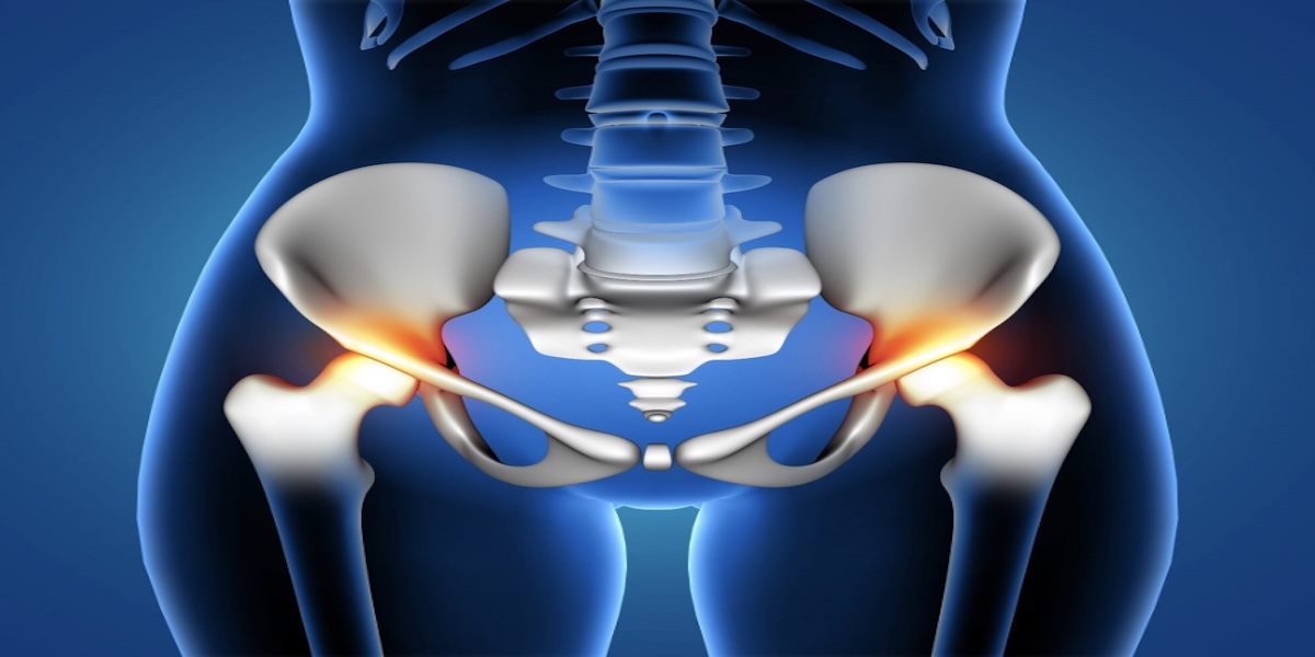 Understanding Osteoporosis and Osteopenia: Causes, Risks, and Prevention