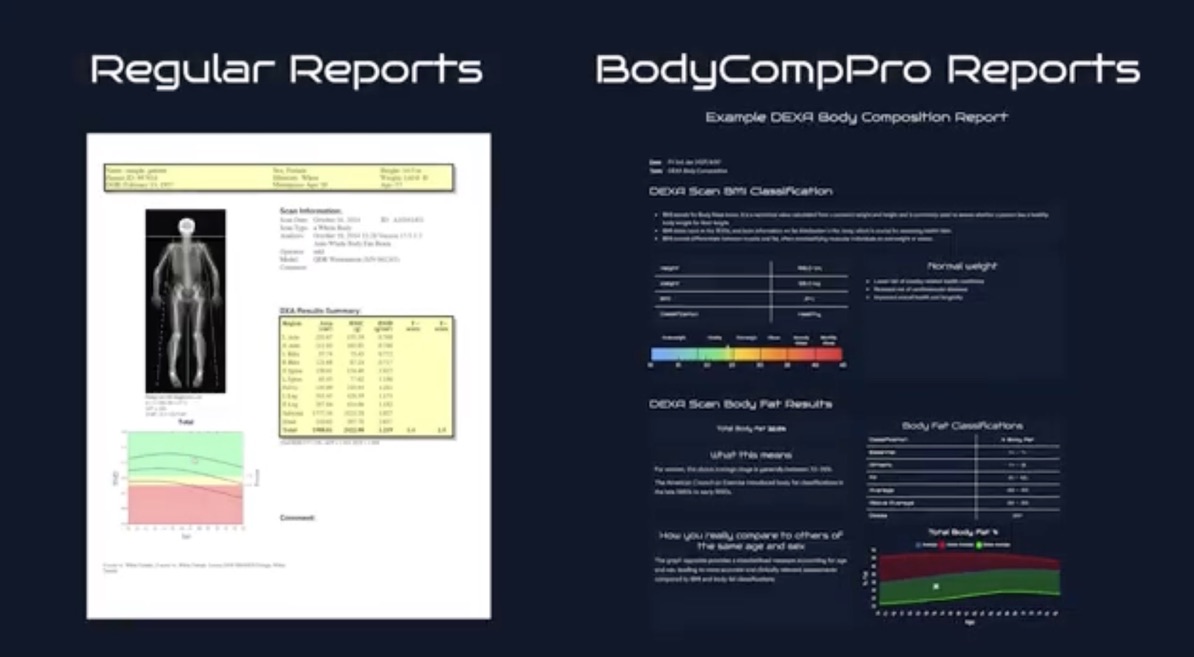 BodyCompPro Reports: The Exclusive Upgrade That Transforms Your Results