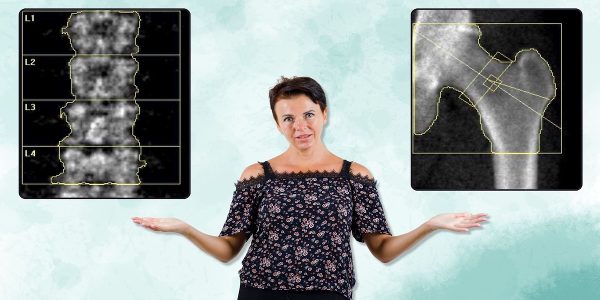 Why Do We Only Scan the Lumbar Spine and Hip in a DEXA Bone Scan? How Two Key Areas Reveal Your Overall Bone Health