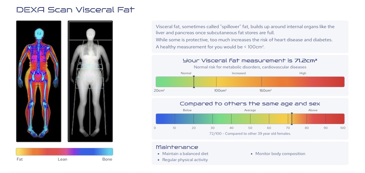 Why Most DEXA Clinics Don’t Focus on Visceral Fat