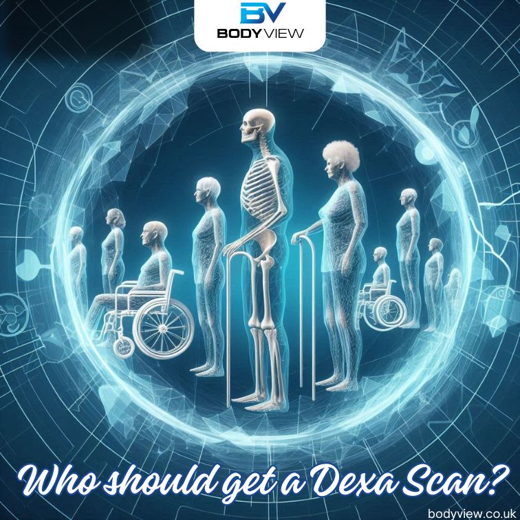 DEXA Scan: Who Should Get This Gold Standard Test for Body Composition and Bone Density?