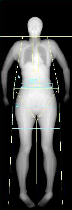 Body composition scan