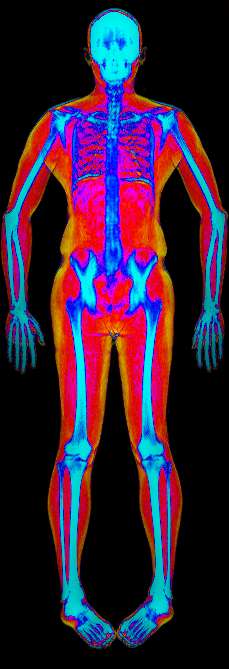 Body scan 20 Jul 2024