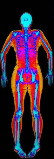 Previous body composition scan