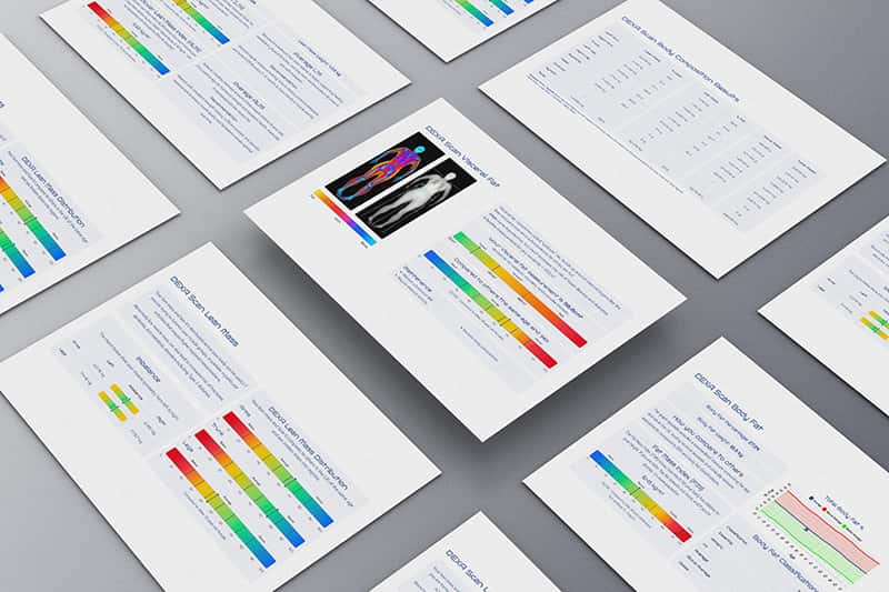 DEXA scanning reports produced in BodyView using BodyCompPro
