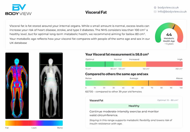 Sample Core report Visceral Fat page with measurement, ranges and scan images