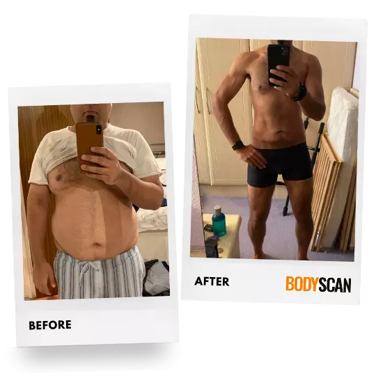Jinal, 38's before and after weight loss pictures