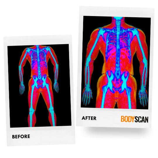 Nathan, 33's before and after DEXA scan images