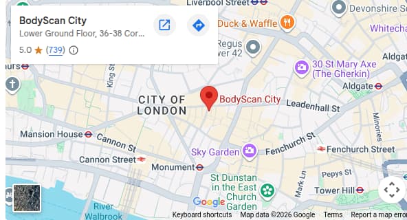 Map preview for BodyScan City