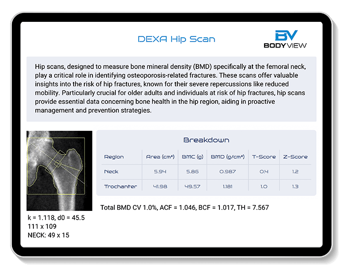 DEXA Body Composition Report example