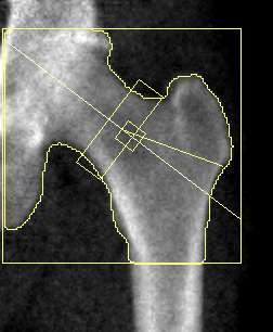 Left hip scan