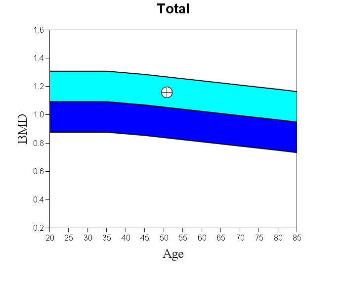 Spine BMD chart