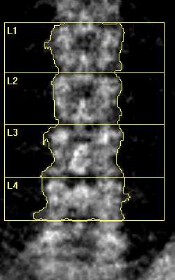Spine scan